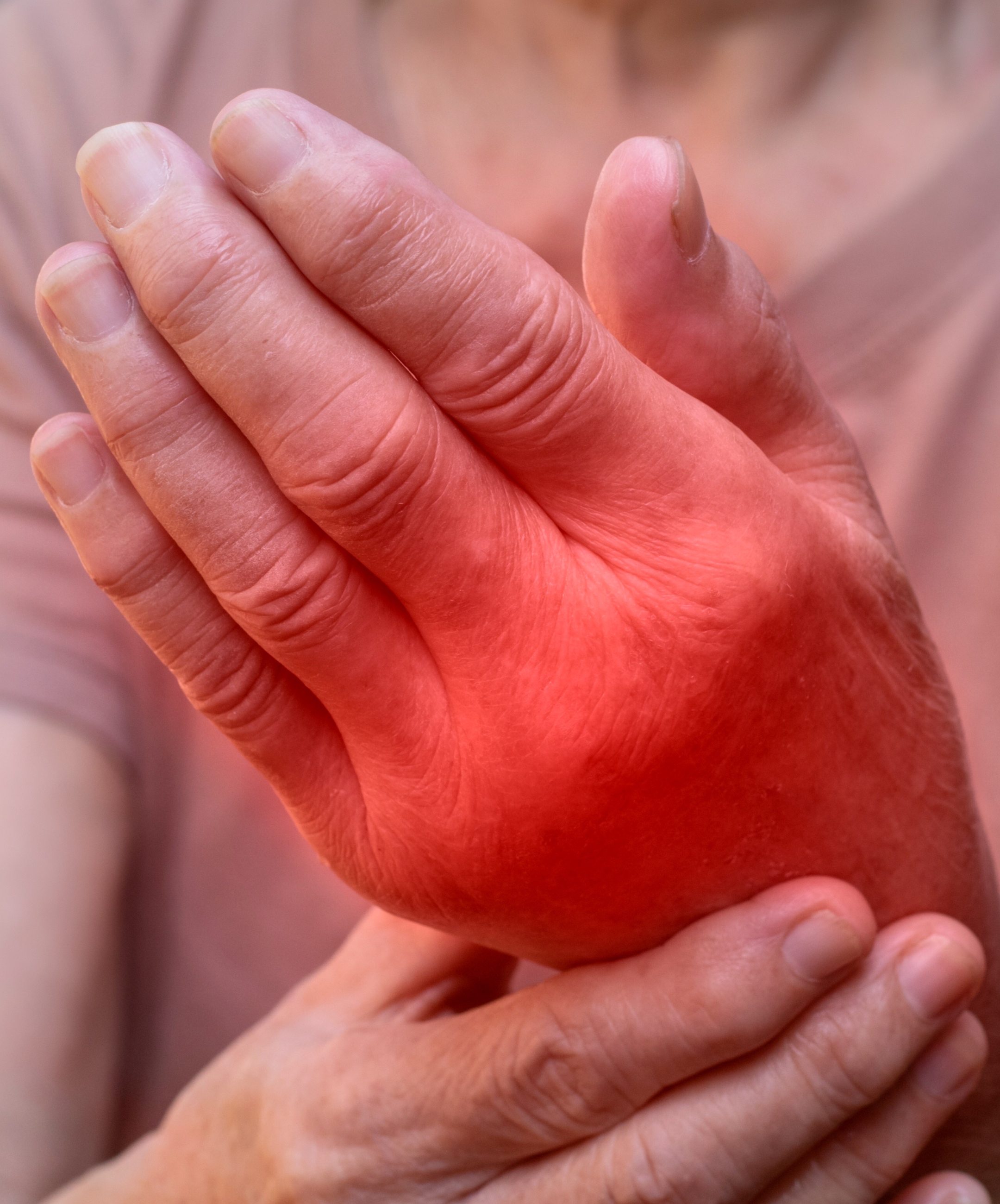 Activated® UA Rx™ Gout Protect